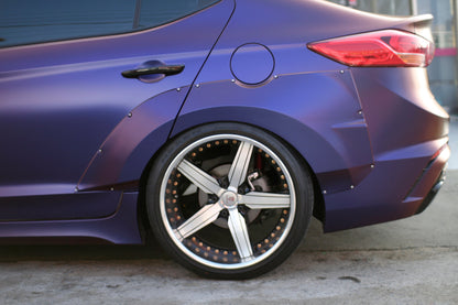 UNR Performance Widebody Fender Flares for Elantra AD 17-18